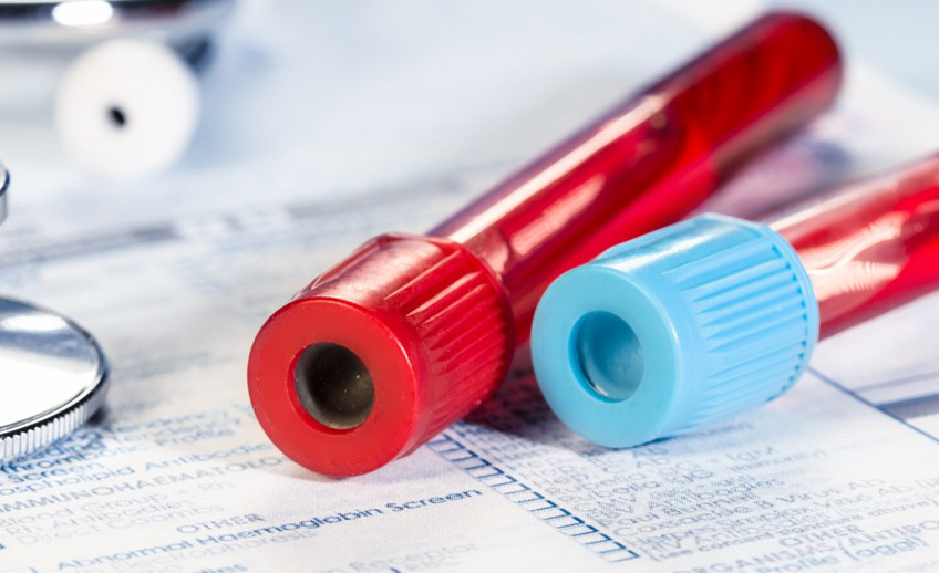 Open Your Healthcare Career with Top-Rated Phlebotomy Training in Rochester, NY